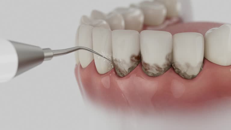 Reliable Dental contractor in Centerville, IA by Dentist Open Now